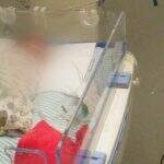 Bebê que nasceu sem ânus passa por cirurgia no HRMS