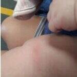 Bebê fica ferida durante vacinação em UBS e pais procuram a polícia