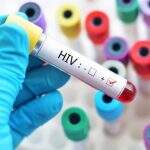 Pesquisa detalha distribuição dos subtipos do HIV no Brasil