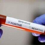 Novo coronavírus causa segunda morte nos Estados Unidos