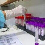 Cientista afirma que China encobriu casos de coronavírus na cidade de Wuhan