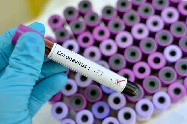 Fiocruz investiga circulação de variante do coronavírus no Amazonas