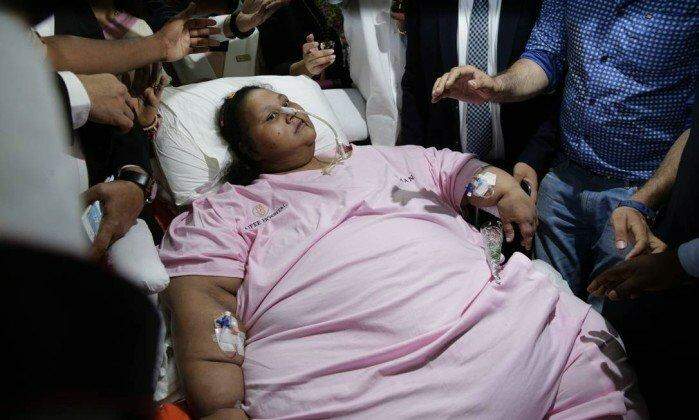Mulher egípcia deixa hospital 325 quilos mais leve após operação
