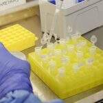Primeiro caso suspeito de coronavírus em MS é descartado após 2° exame em SP