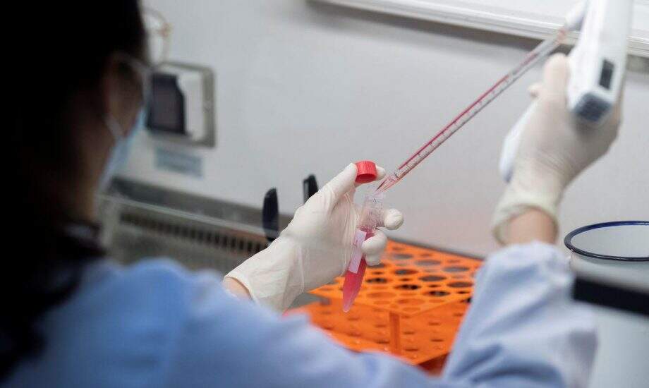 Coronavírus já circulava no Brasil em fevereiro, estima pesquisa