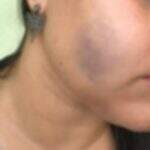 Jovem denuncia que foi agredida a soco por PM na frente de delegacia em MS