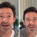Hugh Jackman, o Wolverine, tranquiliza fãs sobre suspeita de novo câncer de pele