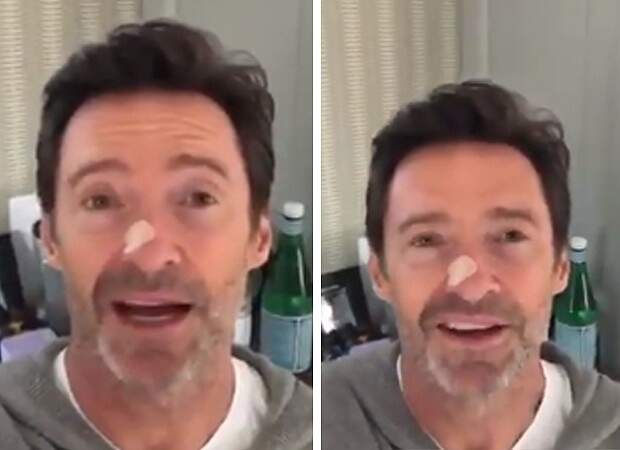 Hugh Jackman, o Wolverine, tranquiliza fãs sobre suspeita de novo câncer de pele