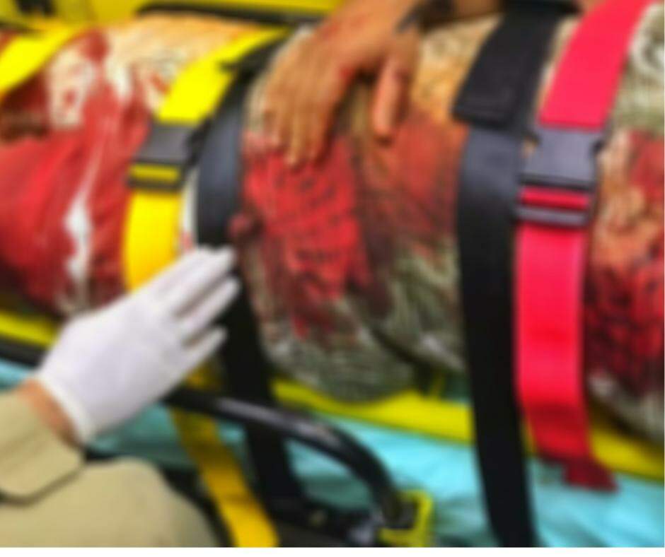 Motociclista tem braço amputado em acidente na Estrada Parque
