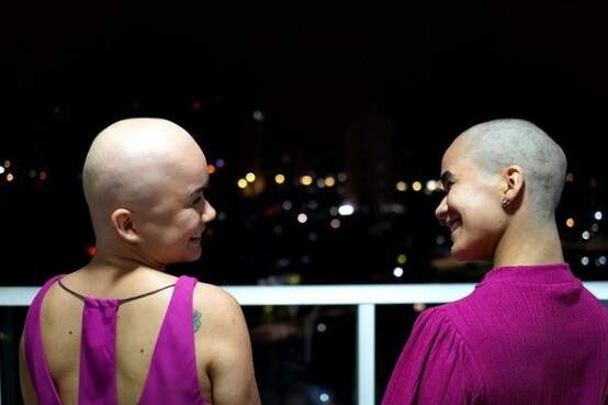 Jovem raspa cabelo para apoiar irmã gêmea diagnosticada com alopecia areata