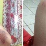 ‘Não consigo mais sair sozinha para nada’, diz jovem agredida em roubo no Tijuca