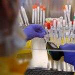 Secretaria de Saúde confirma 3 casos suspeitos da nova variante do coronavírus em MS
