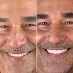 Luciano Szafir mostra resultado de lentes nos dentes