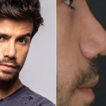 Mariano mostra resultado de nova plástica no nariz: ‘pediram’
