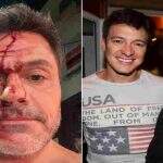 Irmão de Rodrigo Faro sofre acidente de carro em São Paulo: “Nasci de novo”