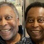 Internado, Pelé muda o visual e filha comemora: “Pintou o cabelo hoje”