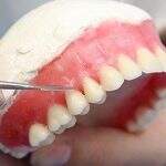 Mulher lesionada após serviço de prótese dentária receberá indenização de dentista
