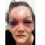 Homem espancou ex com socos e joelhadas, desfigurando o rosto dela