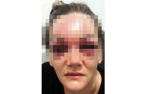 Homem espancou ex com socos e joelhadas, desfigurando o rosto dela