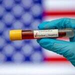 Agência reguladora autoriza laboratório a realizar testes em grupo para coronavírus nos EUA