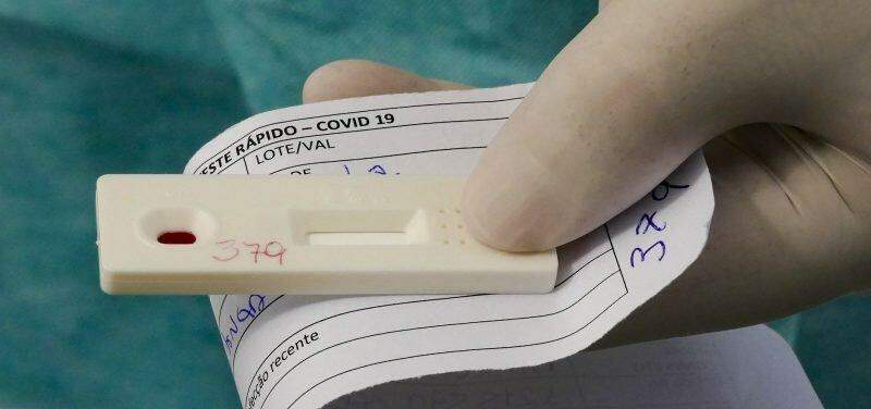 Teste de farmácia para coronavírus chega a R$ 250, identifica carga viral e se há imunidade