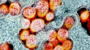 Micrografia eletrônica das partículas do vírus