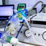 SES analisa pedido de ventiladores pulmonares para UPAs junto ao Ministério da Saúde