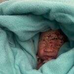 Bebê recém-nascido é achado em lixeira de avião nas Ilhas de Maurício