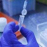 Secretaria confirma quarta morte por H3N2 em Mato Grosso do Sul