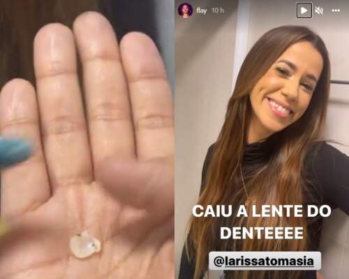 Vídeo: ex-BBB Larissa viraliza após perder dente: 'só se lasca'