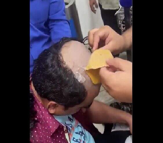 VÍDEO: homem é preso com ouro avaliada em R$ 192 mil em peruca na Índia