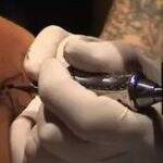Tatuador é condenado a corrigir tatuagem após escrever ‘etérno’ no braço de mulher em Campo Grande
