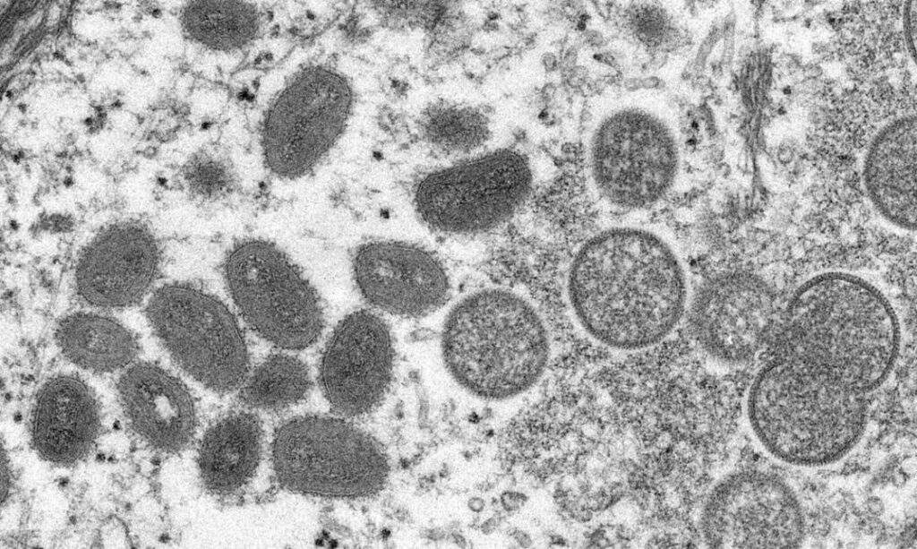 virus variola - Brasil tem dois casos suspeitos de varíola dos macacos, diz Ministério da Saúde