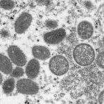 Fiocruz é designada referência em varíola dos macacos para o Ministério da Saúde