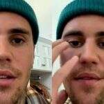 Justin Bieber está com paralisia facial causada por síndrome rara