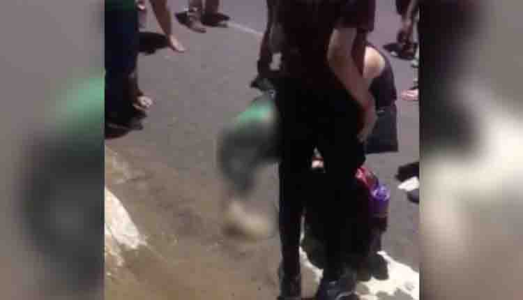 Criança quebra a perna ao ser atropelada na faixa de pedestre em Campo Grande