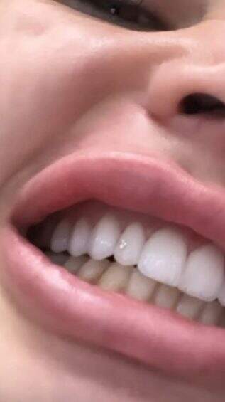 gkay dente - Sorriso de milhões: Gkay coloca diamante no dente