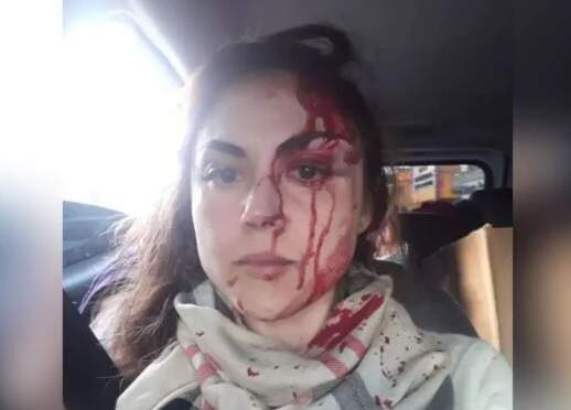 VÍDEO: procuradora-geral de cidade em SP é agredida por colega
