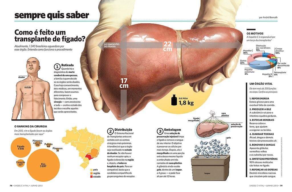 transplante figado - Hepatite misteriosa: transplante de fígado poderá salvar mais de 60 pacientes por ano em MS