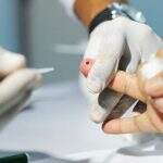 Dourados oferece teste rápido e orientação para hepatites virais neste sábado