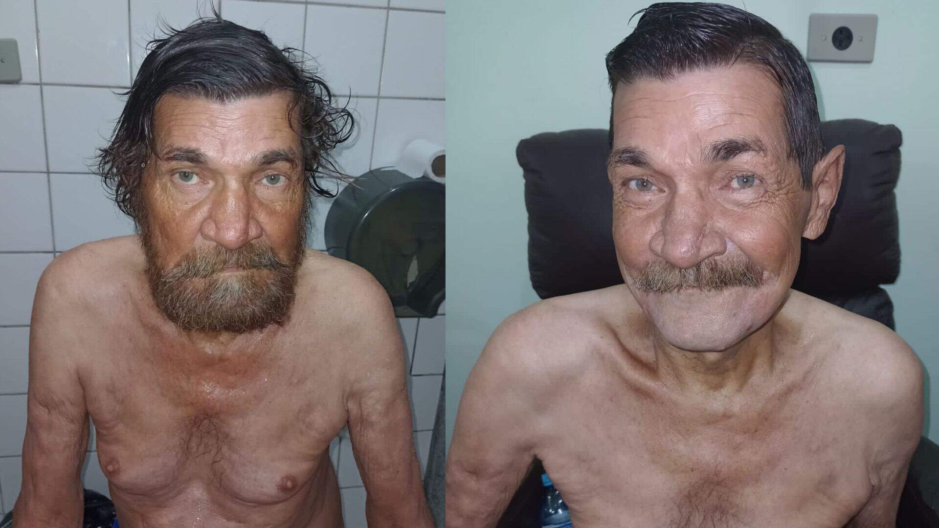 Morador de rua vai para hospital após pneumonia e tem visual transformado: ‘Agora está sorrindo’