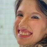 Influenciadora e ativista, Belly Palma morre engasgada aos 29 anos