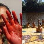 Mordida por jacaré em MS, atriz de Pantanal jorrou sangue em rio cheio de piranhas
