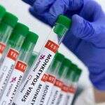 Vacina contra a varíola dos macacos deve chegar ao Brasil este mês