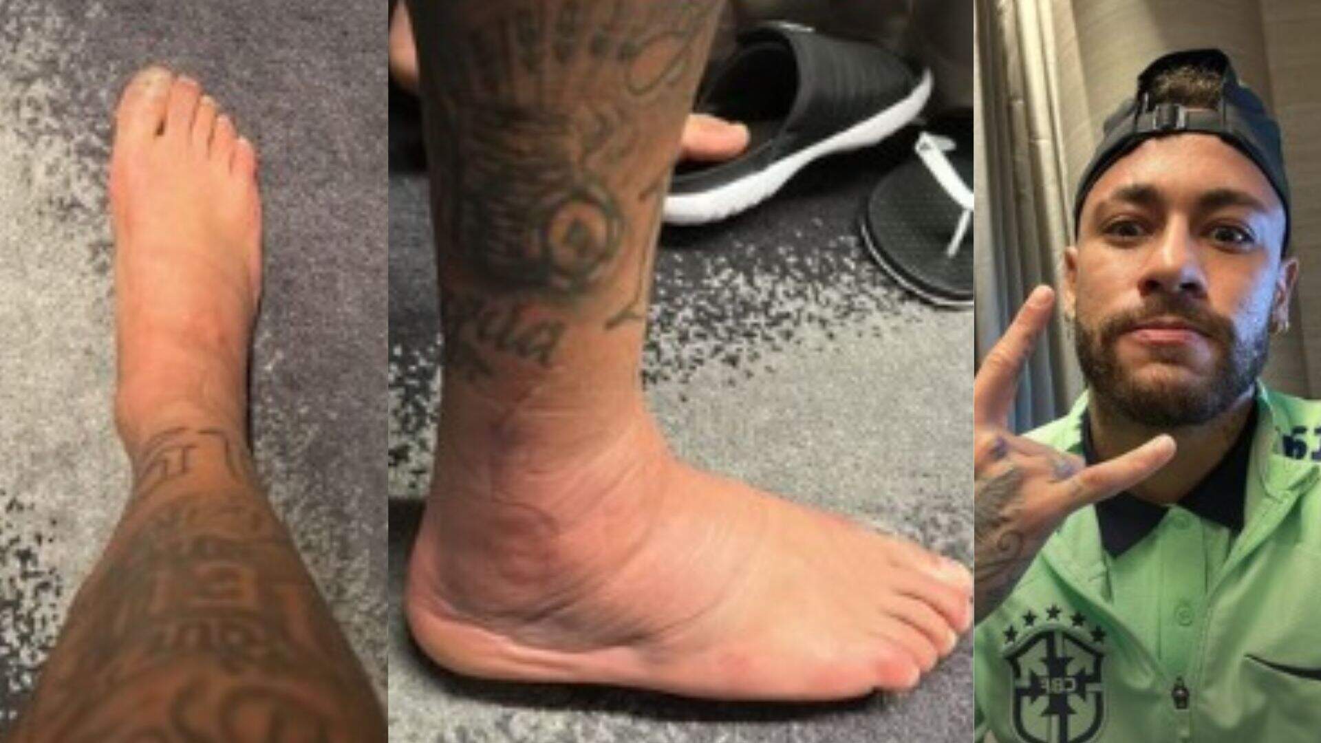 Veja como ficou o tornozelo de Neymar após lesão durante jogo da Copa do Catar
