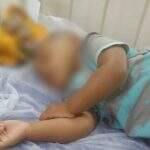 Família reclama de Emei após bebê de 1 ano cair e ser internado em Campo Grande