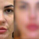 Deolane Bezerra passa por procedimento estético e choca internautas: ‘mudou de rosto’