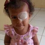 Família faz apelo para compra de prótese ocular após tumor atingir olho de Luna