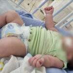 Sem leitos em Campo Grande, bebê de 45 dias aguarda em UPA por transferência para hospital